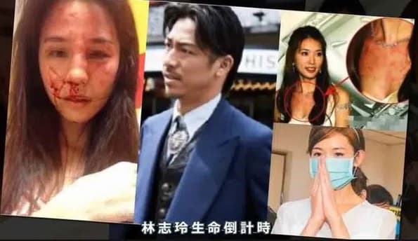 Rộ tin Lâm Chí Linh bị chồng bạo hành và sống ly thân vì không thể mang thai 0