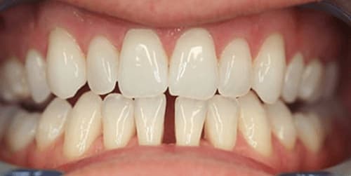 tướng phụ nữ  4