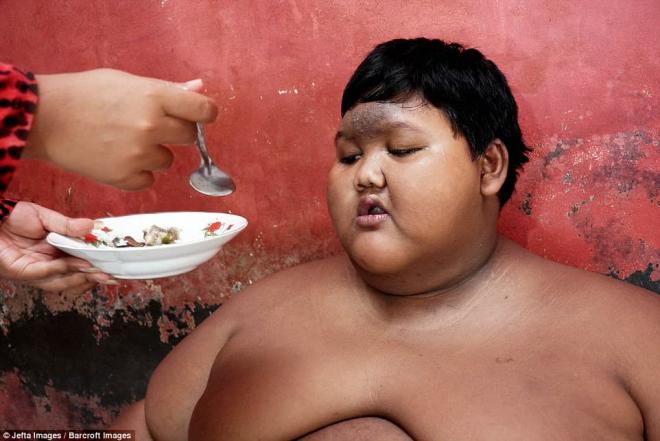 Cậu bé béo nhất thế giới nặng 200kg, miệt mài giảm cân 4 năm giờ gây sốc với diện mạo không thể nhận ra 2