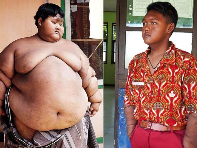Cậu bé béo nhất thế giới nặng 200kg, miệt mài giảm cân 4 năm giờ gây sốc với diện mạo không thể nhận ra 14