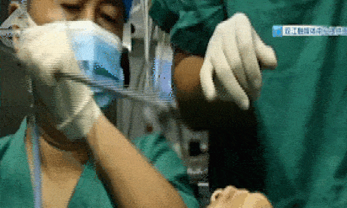 Choáng váng! Con đỉa sống trong khí quản của một cậu bé 5 tuổi suốt 1 năm!