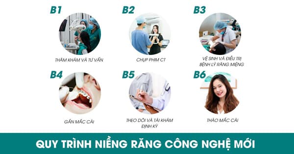 Niềng răng công nghệ mới, Nha khoa thẩm mỹ Queen Smile