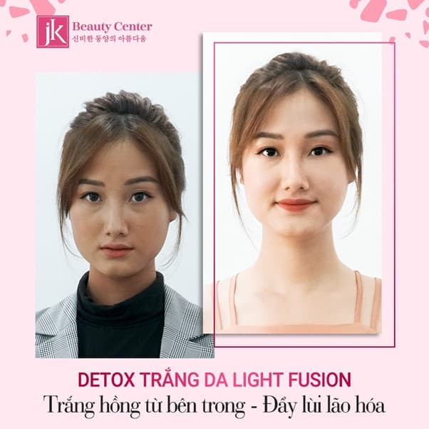 Detox trắng da - Light Fusion, Làm trắng da, Phòng khám đa khoa JK Việt Nam