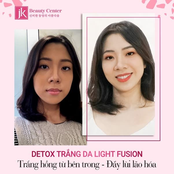 Detox trắng da - Light Fusion, Làm trắng da, Phòng khám đa khoa JK Việt Nam