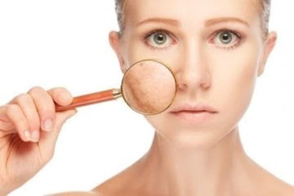 Phòng khám JK Việt Nam, Trị nám và tàn nhang, Pico Fusion