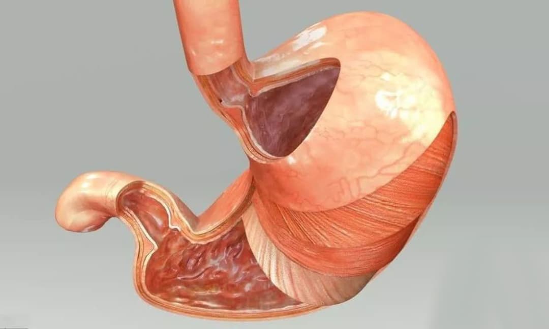 Кольцо шацкого в пищеводе. ГИСО желудка эндоскопия.