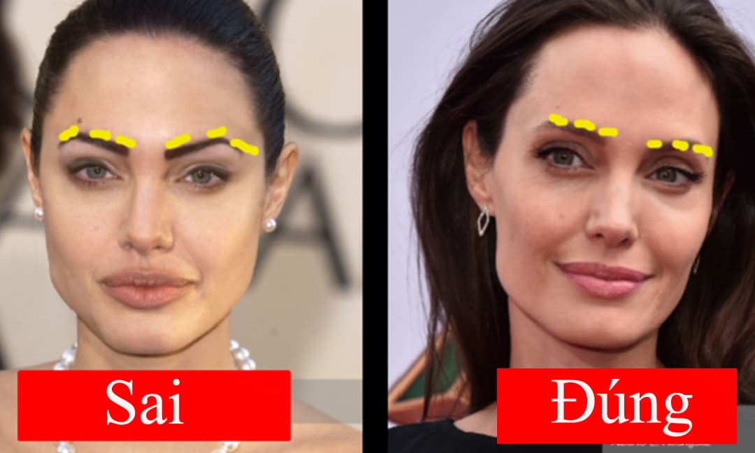Bác sĩ thẩm mỹ Ngô Tuấn, điều trị bằng công nghệ HA Collagen, tạo hình gương mặt, Viện thẩm mỹ Ngô Tuấn