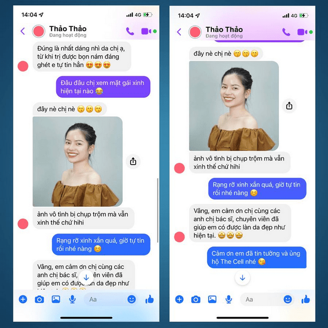 Công nghệ Max Cell, xóa nám và tàn nhang, Phòng khám Thẩm mỹ The Cell Việt Nam