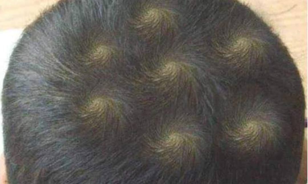 Mách bạn 15 cách khắc phục xoáy tóc tuyệt vời nhất  Tin học Đông Hòa