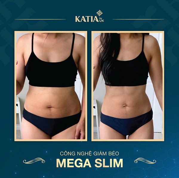 Mega slim, công nghệ giảm béo an toàn, Thẩm mỹ viện Katia