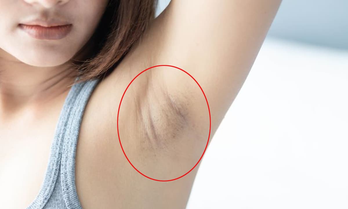 HLV dinh dưỡng Lê Hương, phương pháp giảm cân  khoa học