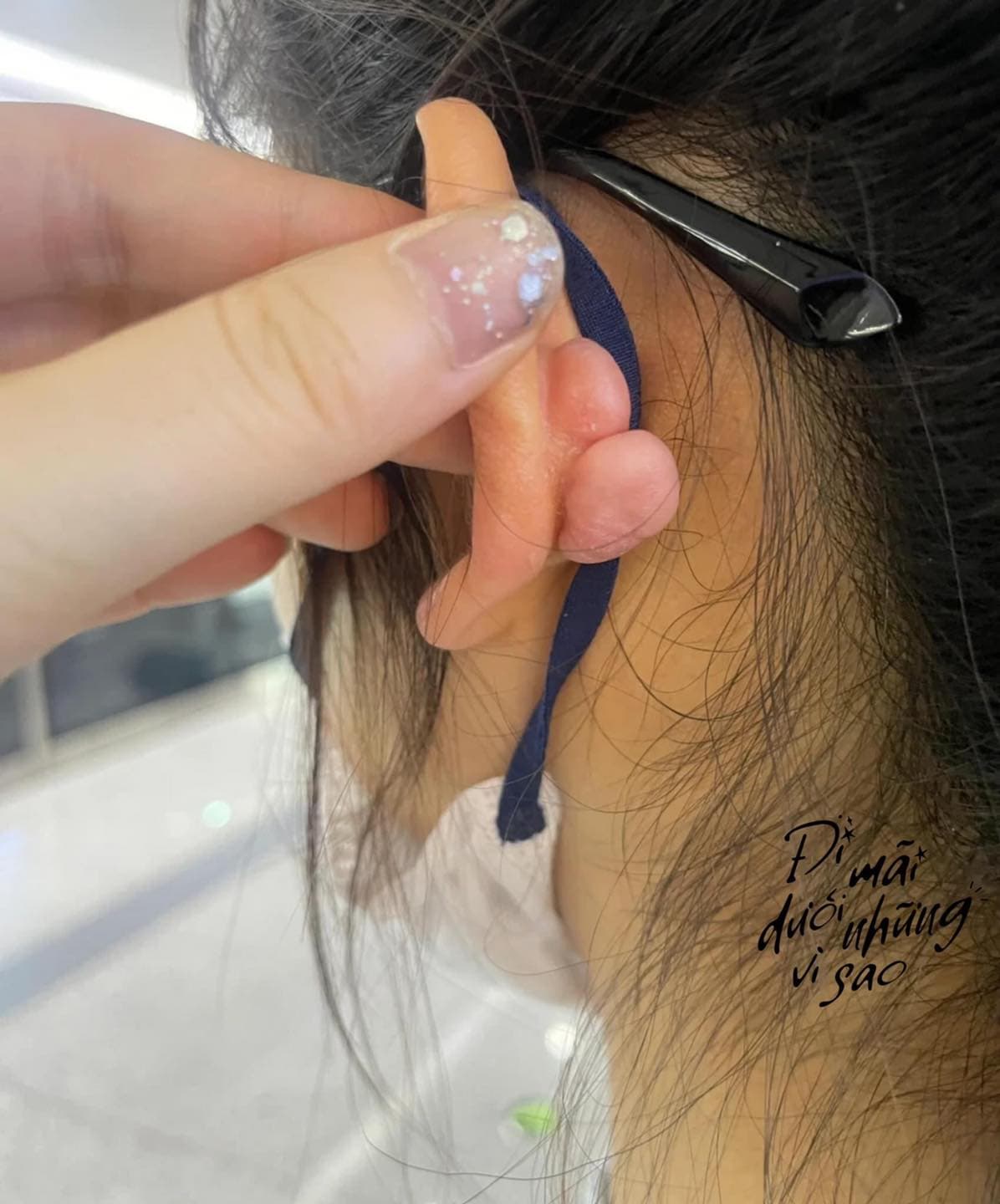 xỏ khuyên tai, tác hại của xỏ khuyên tai, khuyên tai