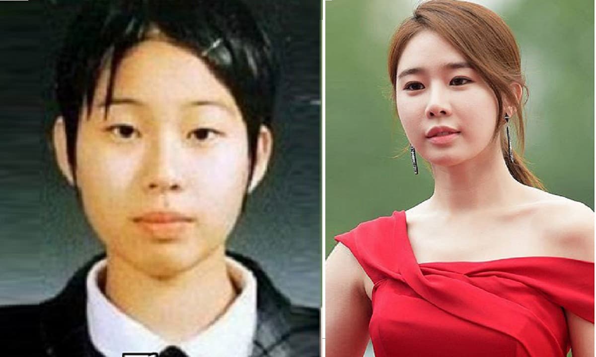 Yoo In Na , sao Hàn, sao phẫu thuật thẩm mỹ