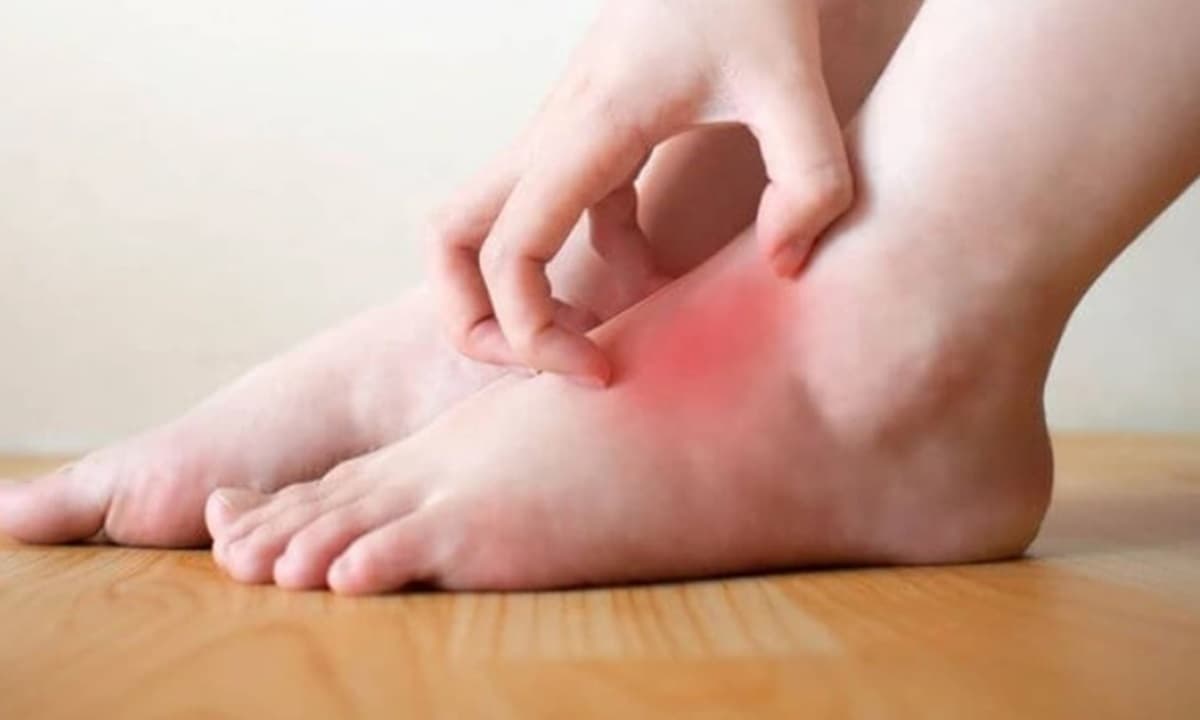 Nếu 3 hiện tượng này xuất hiện ở bàn chân của bạn thì có thể biến chứng của bệnh tiểu đường đang đến gần