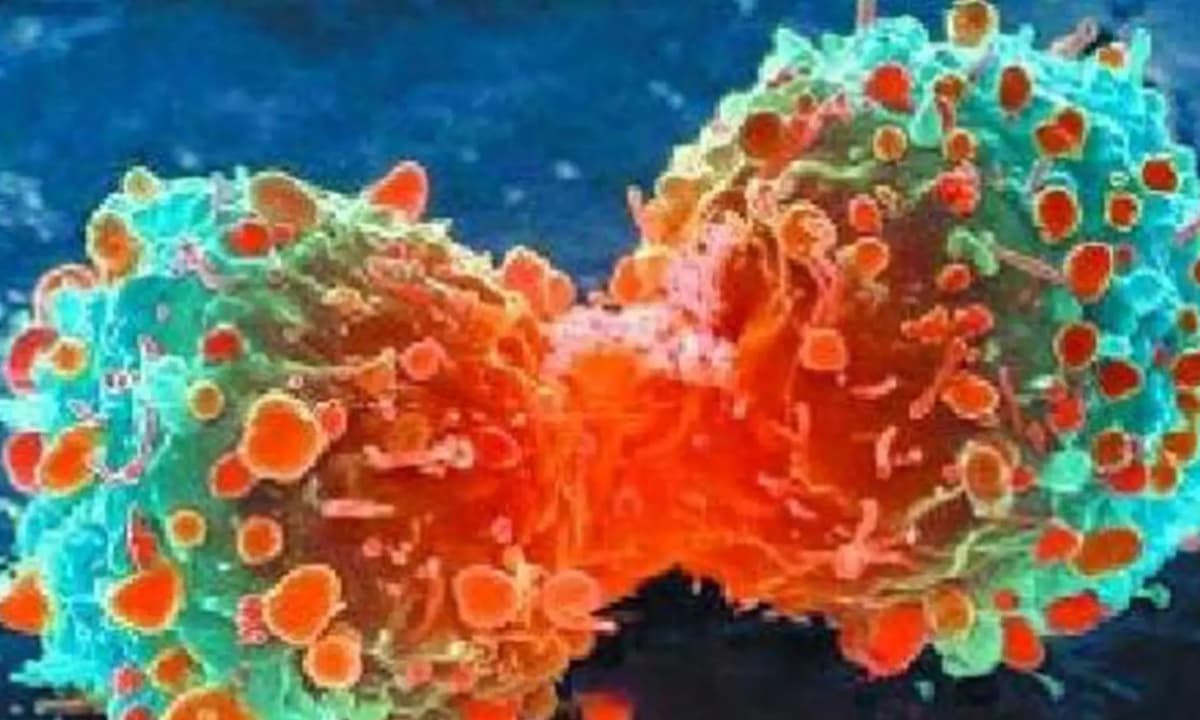 Tế bào ung thư giết người? Nhưng khi con người chết đi, tại sao tế bào ung thư không chết?