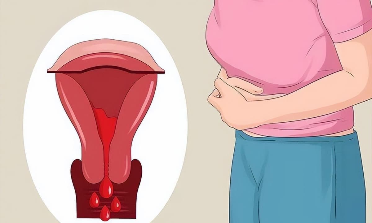 Khi phụ nữ đang trong kỳ kinh nguyệt hãy nhớ 2 lần rửa và 3 không rửa để giảm sự xâm nhập của hơi ẩm và giúp tử cung khỏe mạnh hơn