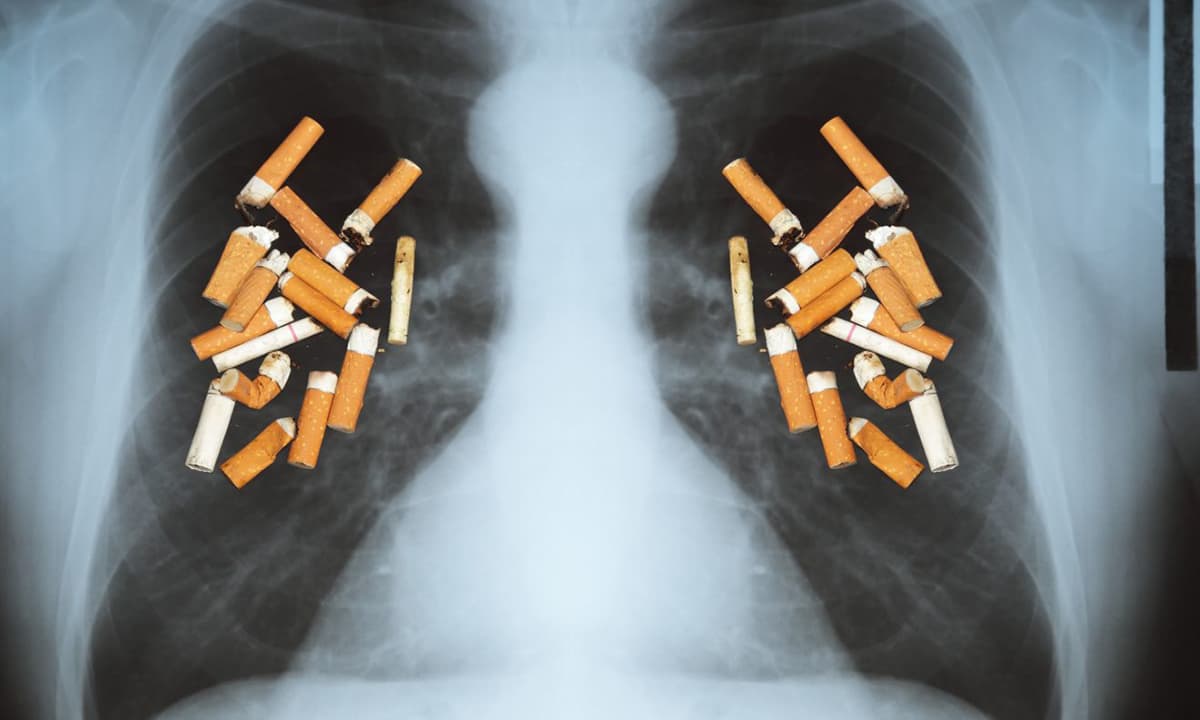 Sau khi cai thuốc lá thành công, phổi có trở lại bình thường được không? Bác sĩ nhắc nhở: Cố gắng không vượt quá độ tuổi này khi bỏ thuốc lá