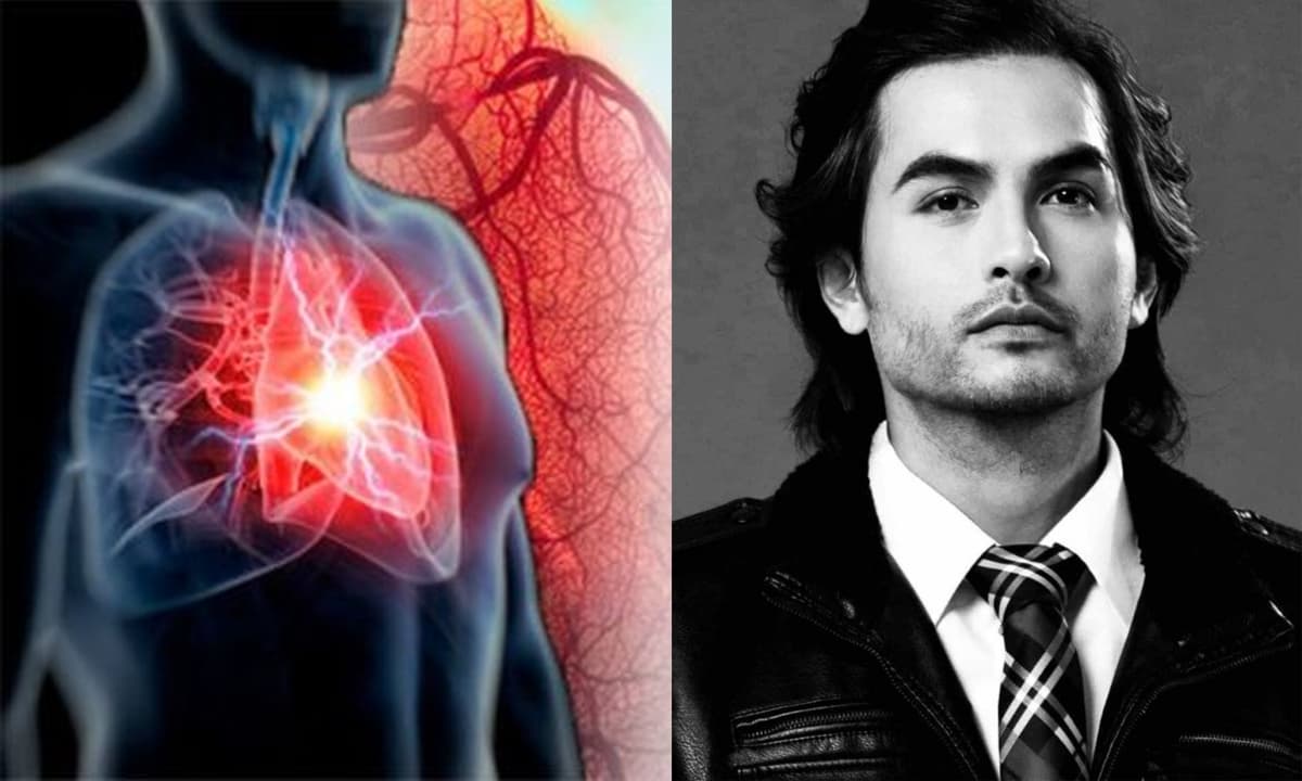 Nhồi máu cơ tim - căn bệnh khiến siêu mẫu Đức Tiến qua đời ở tuổi 44 nguy hiểm như thế nào? Giờ vàng điều trị nhất định không được bỏ lỡ