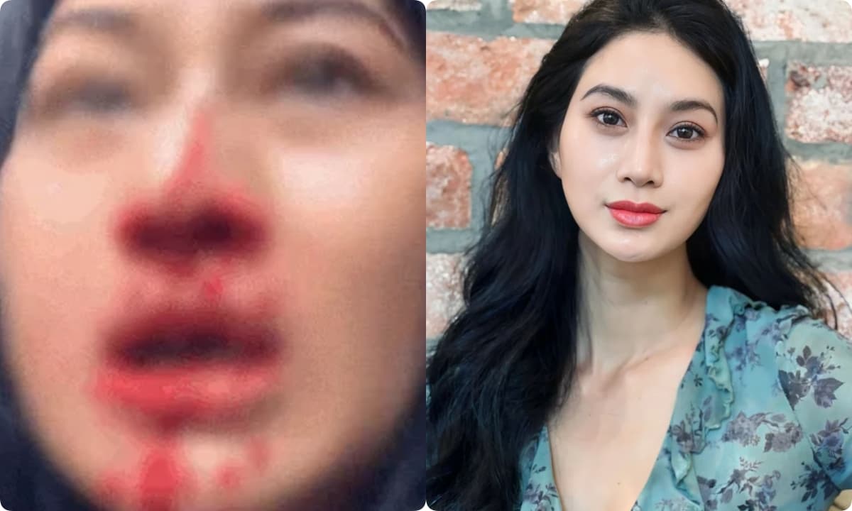Nữ diễn viên Việt Phi Ngọc Ánh liên tục la hét cầu cứu trong livestream với khuôn mặt đầy máu 