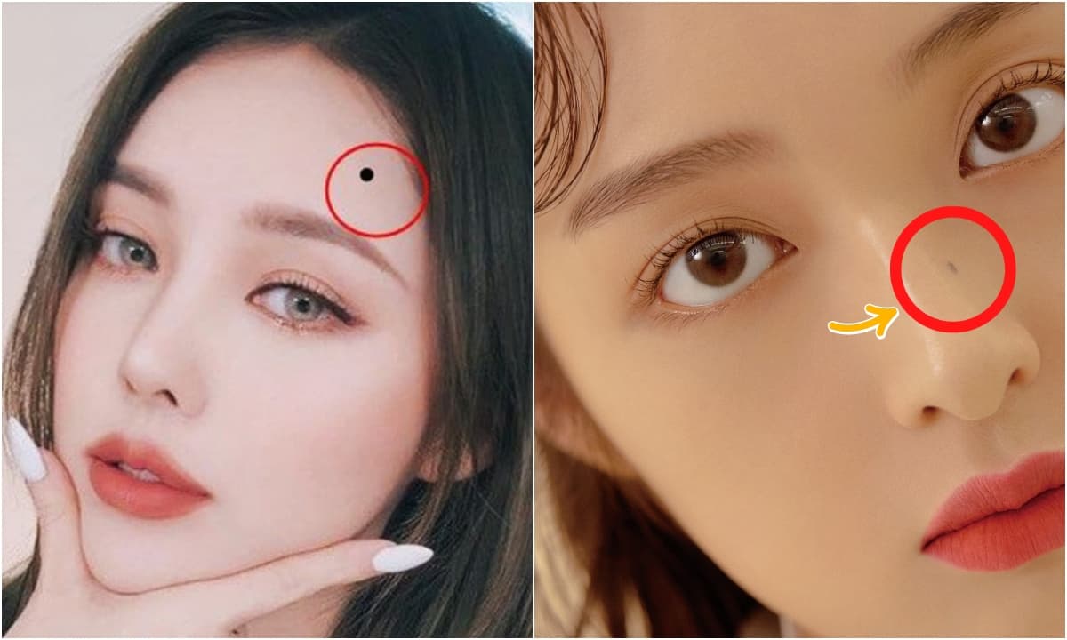 6 vị trí nốt ruồi kém may mắn, báo hiệu tình duyên lận đận, hao tài tốn lộc ở phụ nữ
