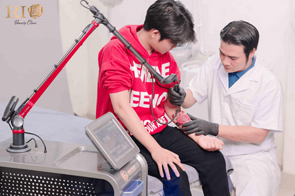 Xoa-hinh-xam-2.png 0 xóa hình xăm, Thẩm Mỹ Rio Beauty Clinic