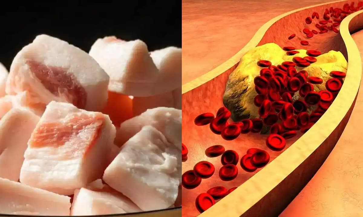 Đại học Harvard vừa có một khám phá đáng kinh ngạc: Những người thường xuyên tránh ăn thịt mỡ có thể giảm đáng kể tình trạng đông máu? Điều này có đúng không?