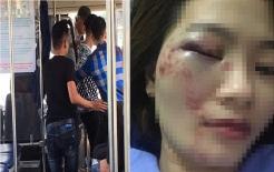 Nữ phụ xe buýt bị hành hung đúng ngày 20/10: Đã xác định nhóm 4 thanh niên gây án