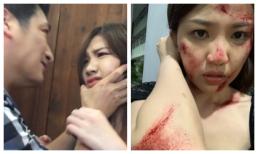 Tiểu tam của 'Hoa hồng bên ngực trái' - Lương Thanh bỗng đăng ảnh tơi tả, lộ kết cục của bản thân trong phim?