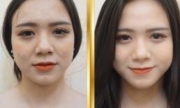 Không phẫu thuật để căng da trẻ hóa, dưới đây là những cách an toàn mà hiệu quả