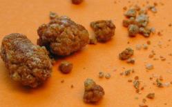 7 thói quen 'nuôi sỏi to lên' trong cơ thể: Hãy sớm thay đổi để không bị sỏi hóa nội tạng