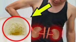 Người thận xấu thường có 5 hiện tượng vào buổi sáng: Nếu bạn không có thì xin chúc mừng, thận bạn rất khỏe mạnh