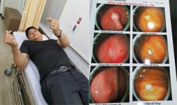 Tình cờ đi khám sức khỏe, diễn viên Minh Tiệp phát hiện bị polyp đại tràng và polyp dạ dày