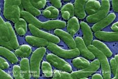 Vi khuẩn Vibrio Vulnificus là gì? Tại sao nó có thể gây chết người nếu không cẩn thận khi ăn và tiếp xúc với hải sản?
