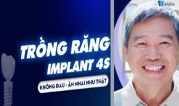 Bỏ ra 200 triệu đi trồng răng Implant có xứng đáng không?