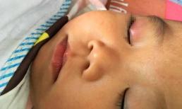 Trẻ 3 tuổi đổ keo 502 vào mắt, cách xử lý của ông bố khiến đến bác sĩ cũng phải thán phục