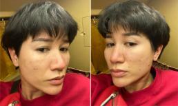 Trang Trần mặt nhợt nhạt nổi mụn chi chít, mệt mỏi do nhiều ngày thiếu ngủ