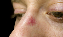 Bước qua tuổi 40, có 4 dấu hiệu cảnh báo ung thư không thể không đề phòng