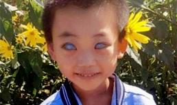 Cậu bé sinh ra với 'đôi mắt ác quỷ' bị cha ruột bỏ rơi khi mới 4 tháng tuổi