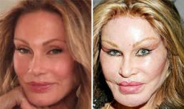 Jocelyn Wildenstein - từ xuất thân danh giá xinh đẹp đến thảm họa thẩm mỹ nợ nần