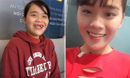 Ngân Thảo khoe bộ răng sứ mới, không còn là 'thánh sún' như trước