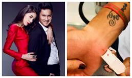 Công Vinh than bị cây đâm 'tí chết', Thuỷ Tiên vẫn cà khịa nhưng nhìn vết thương mới tức dùm nữ ca sĩ