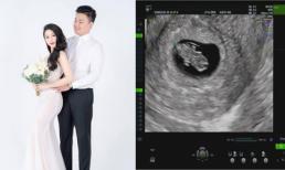 Hot girl Vân Navy mang thai lần đầu với chồng doanh nhân sau 1 năm kết hôn