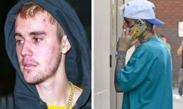 Suốt thời gian dài bị chê diện mạo nát bươm, Justin Bieber đau đớn nói ra nguyên nhân phía sau khiến nhiều người câm nín 