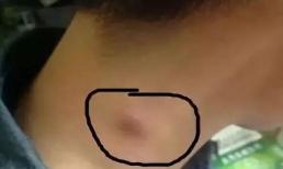 Cổ là rada 'dò' ung thư, một khi trên cổ có 3 dấu hiệu này chứng tỏ tế bào ung thư đã xuất hiện