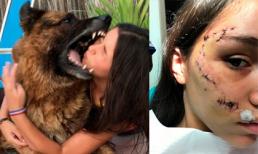 Chơi trội cho đầu vào mồm chó tự sướng, cô gái nhận hậu quả khâu 40 mũi