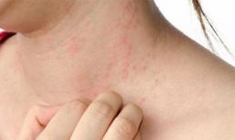 Những người gan kém thường có dấu hiệu '1 ngứa 3 đen' trên cơ thể