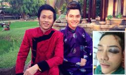 Tiết lộ tình hình sức khỏe hiện tại của con trai nuôi danh hài Hoài Linh: đã tỉnh tại, cục máu bầm tạm ngưng phát triển