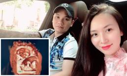 Khắc Việt tiết lộ vợ mang thai đôi 1 trai, 1 gái