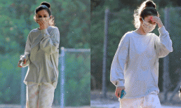 Selena Gomez sụt cân sau một thời gian tiết lộ bị bệnh rối loạn lưỡng cực 