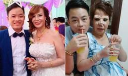 'Cô dâu 62 tuổi' Thu Sao công khai ảnh hậu 'dao kéo' mũi, chỉnh trang lông mày khiến dân mạng rùng mình